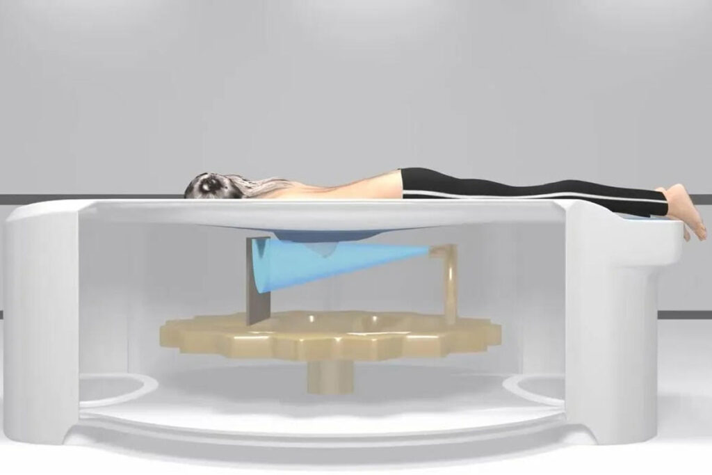 Woman undergoing Koning Vera Breast CT scan for early cancer detection